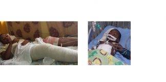 Guyana – Baby shot six times