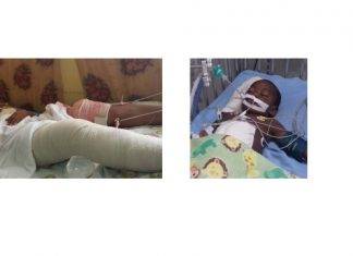 Guyana – Baby shot six times