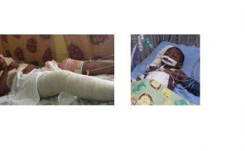 Guyana – Baby shot six times