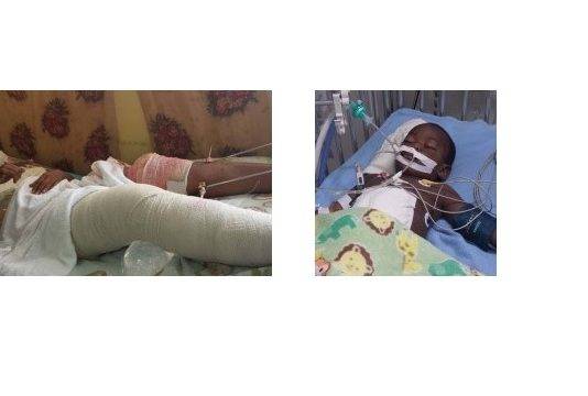 Guyana – Baby shot six times