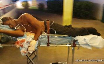 ***VIDEO UPDATE***: Jamaican man shot multiple times on Backstreet