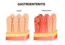 Ministry of Public Health advises community to take measures to prevent gastroenteritis