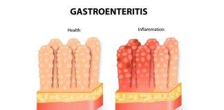 Ministry of Public Health advises community to take measures to prevent gastroenteritis