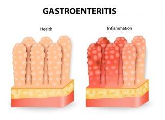 Ministry of Public Health advises community to take measures to prevent gastroenteritis