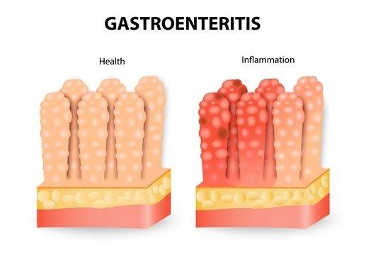 Ministry of Public Health advises community to take measures to prevent gastroenteritis