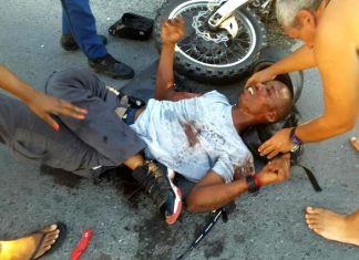 Five accidents reported on Sunday