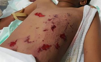 *** WARNING *** Claude Peterson: EXTREMELY DANGEROUS ILLEGAL FIREWORKS!!!