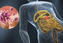 Ministerio de Salud Pública aconseja a la población tomar medidas para evitar la gastroenteritis