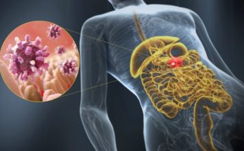 Ministry of Public Health advises community to take preventive measures to mitigate spread of gastroenteritis