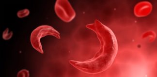 SMMC teams up with SSCF on World Sickle Cell Day