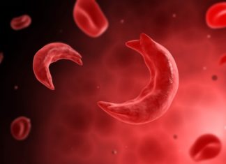 SMMC teams up with SSCF on World Sickle Cell Day