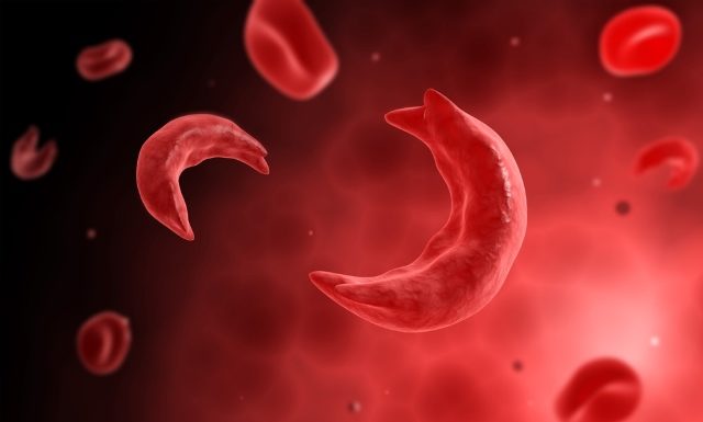 SMMC teams up with SSCF on World Sickle Cell Day