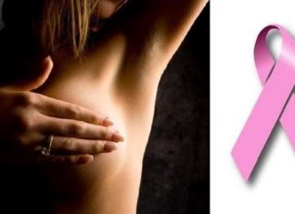 CPS and Partners to Resume Women Breast Abnormalities Screenings