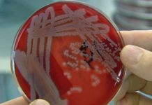 CPS crea conciencia sobre la leptospirosis