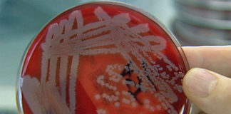 CPS crea conciencia sobre la leptospirosis