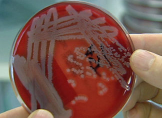 CPS creates awareness about leptospirosis