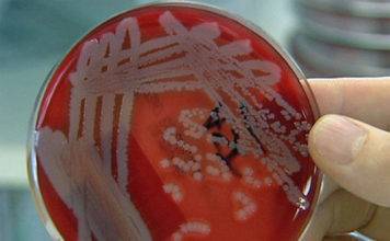 CPS crea conciencia sobre la leptospirosis