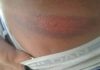 Joven dominicano denunció fue agredido brutalmente por agentes policiales