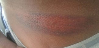 Joven dominicano denunció fue agredido brutalmente por agentes policiales