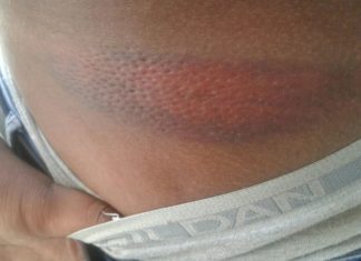 Joven dominicano denunció fue agredido brutalmente por agentes policiales
