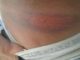 Joven dominicano denunció fue agredido brutalmente por agentes policiales