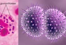 Resistance in Gonorrhoeae: PAHO calls for strengthened surveillance and laboratory diagnostics