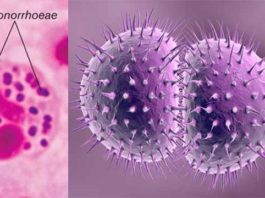 Resistance in Gonorrhoeae: PAHO calls for strengthened surveillance and laboratory diagnostics