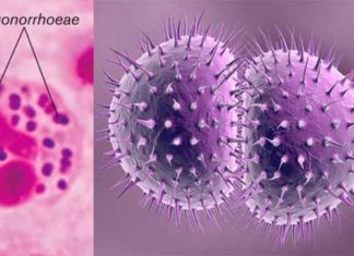 Resistance in Gonorrhoeae: PAHO calls for strengthened surveillance and laboratory diagnostics