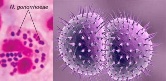 Resistance in Gonorrhoeae: PAHO calls for strengthened surveillance and laboratory diagnostics