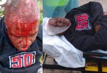 Notorious Dean Benjamin injured a neighbor with a stone during a fight