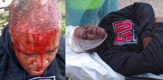 Notorious Dean Benjamin injured a neighbor with a stone during a fight