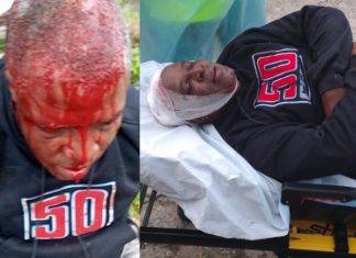 Notorious Dean Benjamin injured a neighbor with a stone during a fight