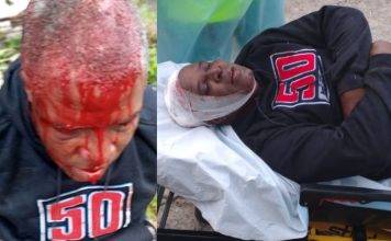 Notorious Dean Benjamin injured a neighbor with a stone during a fight
