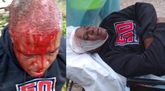 Notorious Dean Benjamin injured a neighbor with a stone during a fight