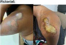 Attorney Sjamira Roseburg provides update on case of American tourist