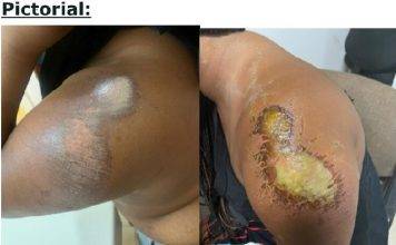 Attorney Sjamira Roseburg provides update on case of American tourist