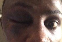 Prisoner in isolation cell in Pointe Blanche Prison severely beaten and hospitalized