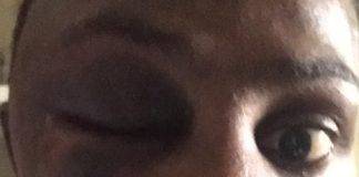 Prisoner in isolation cell in Pointe Blanche Prison severely beaten and hospitalized