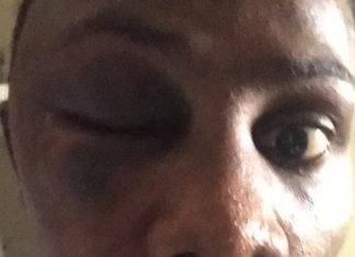 Prisoner in isolation cell in Pointe Blanche Prison severely beaten and hospitalized