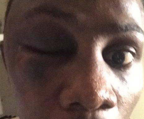 Prisoner in isolation cell in Pointe Blanche Prison severely beaten and hospitalized