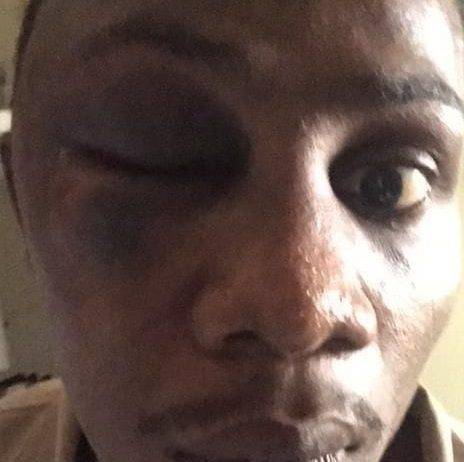 Prisoner in isolation cell in Pointe Blanche Prison severely beaten and hospitalized
