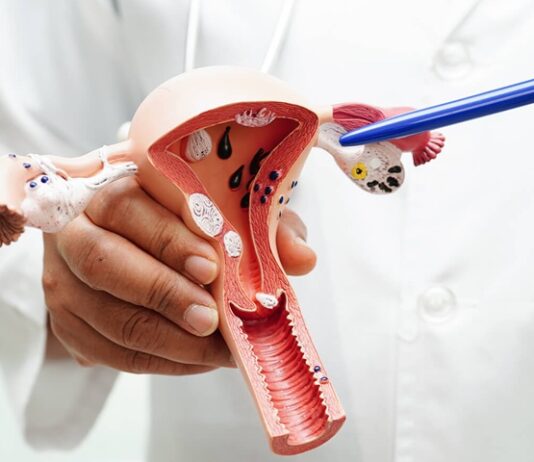 Cervical Cancer: Early Detection is Your Best Protection