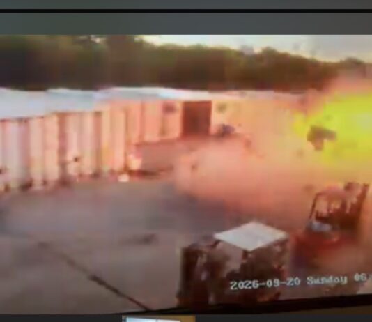 Serious Burn Incident at Maho Sonesta Resort